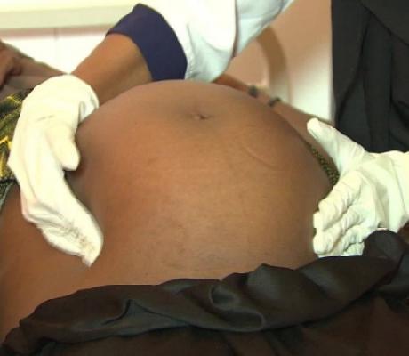 These pregnancies expose girls to later complications according to an expert