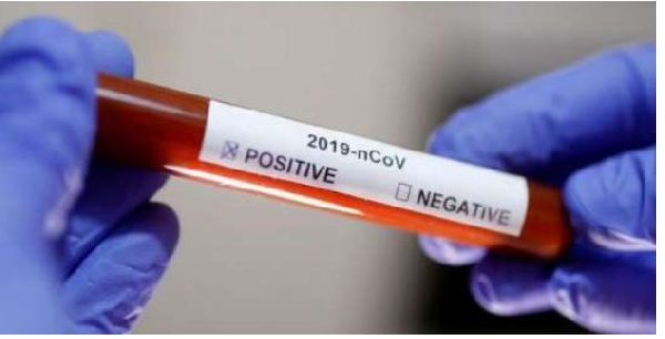Coronavirus: Africa’s death toll hits 383, as cases rise to 8,596 – WHO