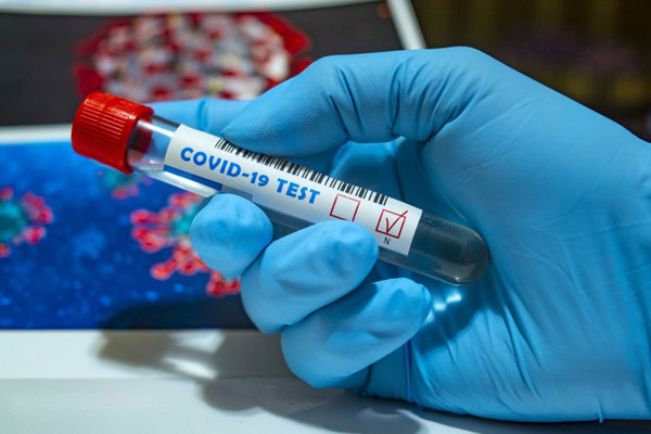 File Photo: Coronavirus