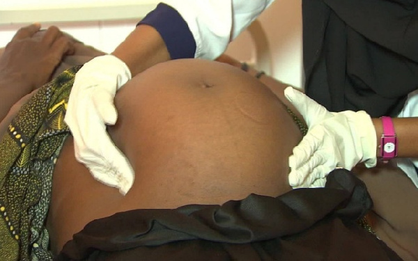 These pregnancies expose girls to later complications according to an expert