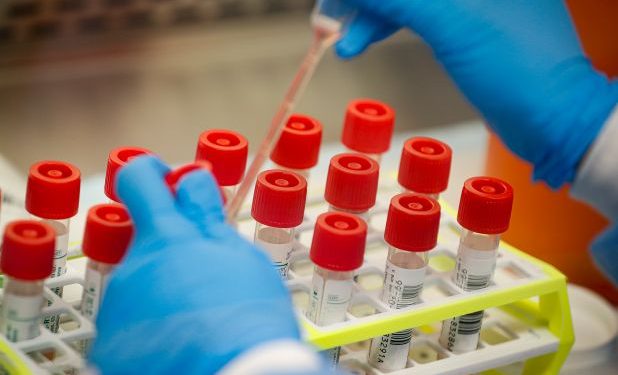 CORONAVIRUS-TEST-KITS