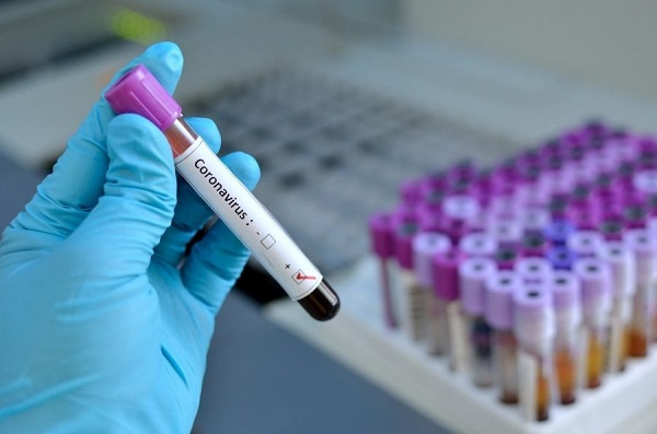 coronavirus-test-kits