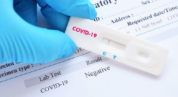 South Africa to conduct mass community testing for COVID-19 - Health minister