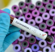 Coronavirus